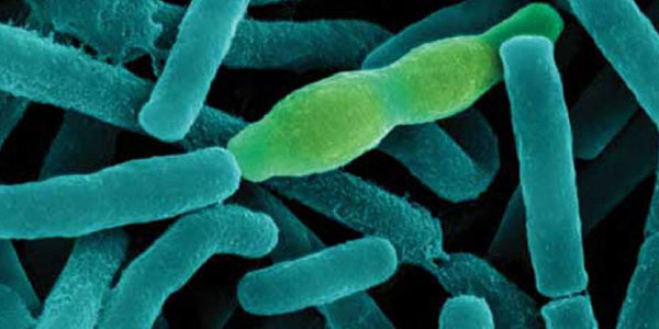 Bacteria de Anthrax